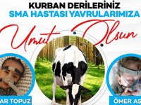 KURBAN DERİLERİ SMA HASTASI ÇOCUKLARA UMUT OLDU